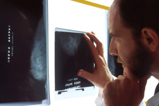Veste bună pentru pacienții oncologici - Radioterapia stereotactică, decontată